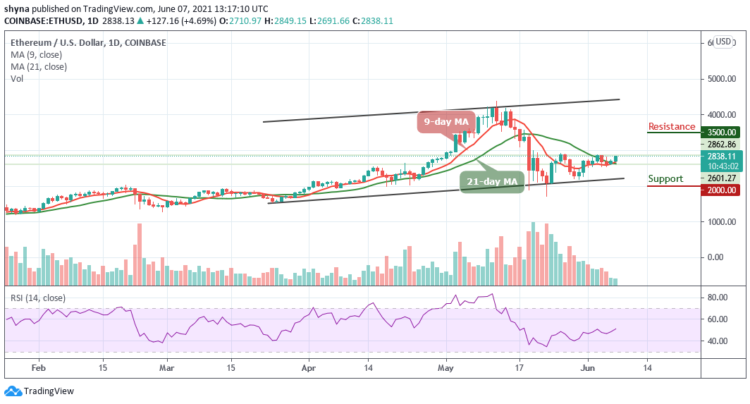 Ethereum Price Prediction: ETH/USD Settles Above $2800